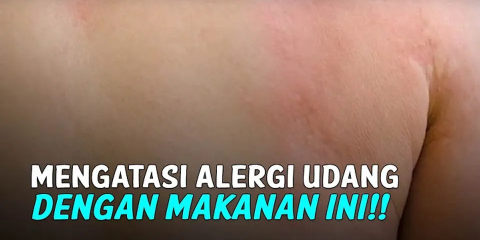 Apakah alergi udang bisa sembuh